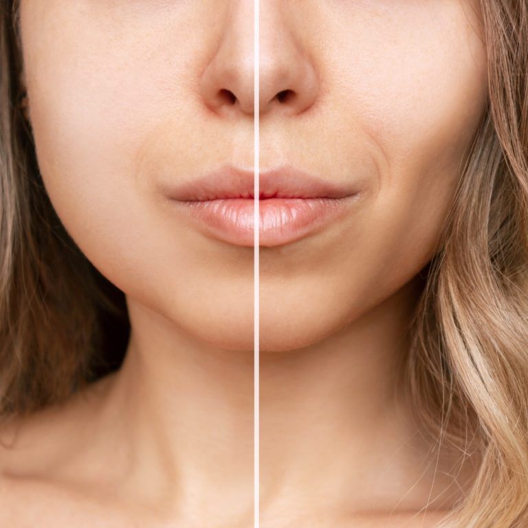 Comparison of skin textures and tones on face.