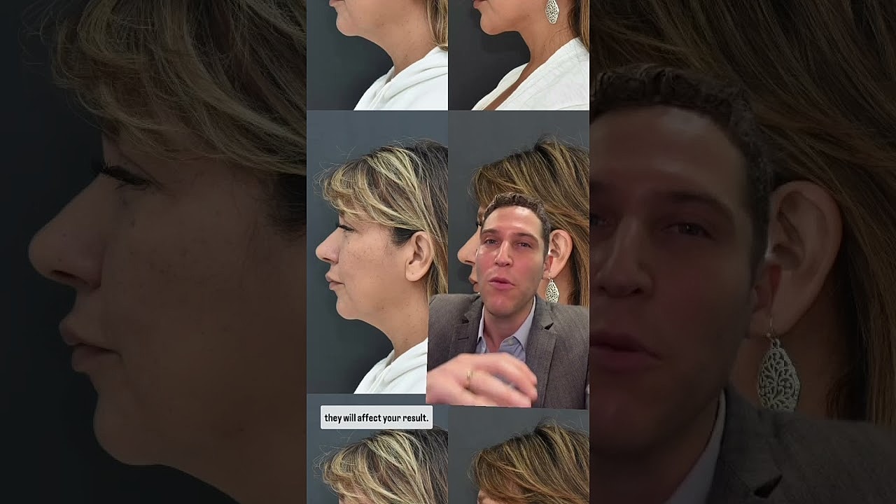 Profile images and consultation about aesthetic results.