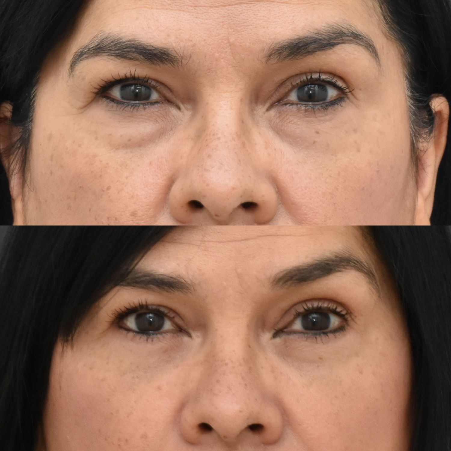 Before and after eye treatment close-up.