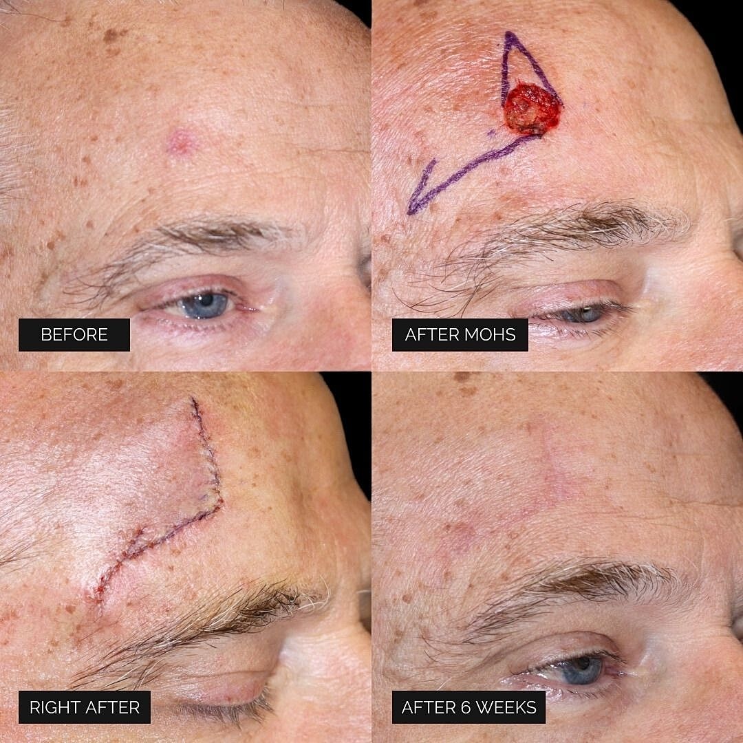 Reconstruction Before & After