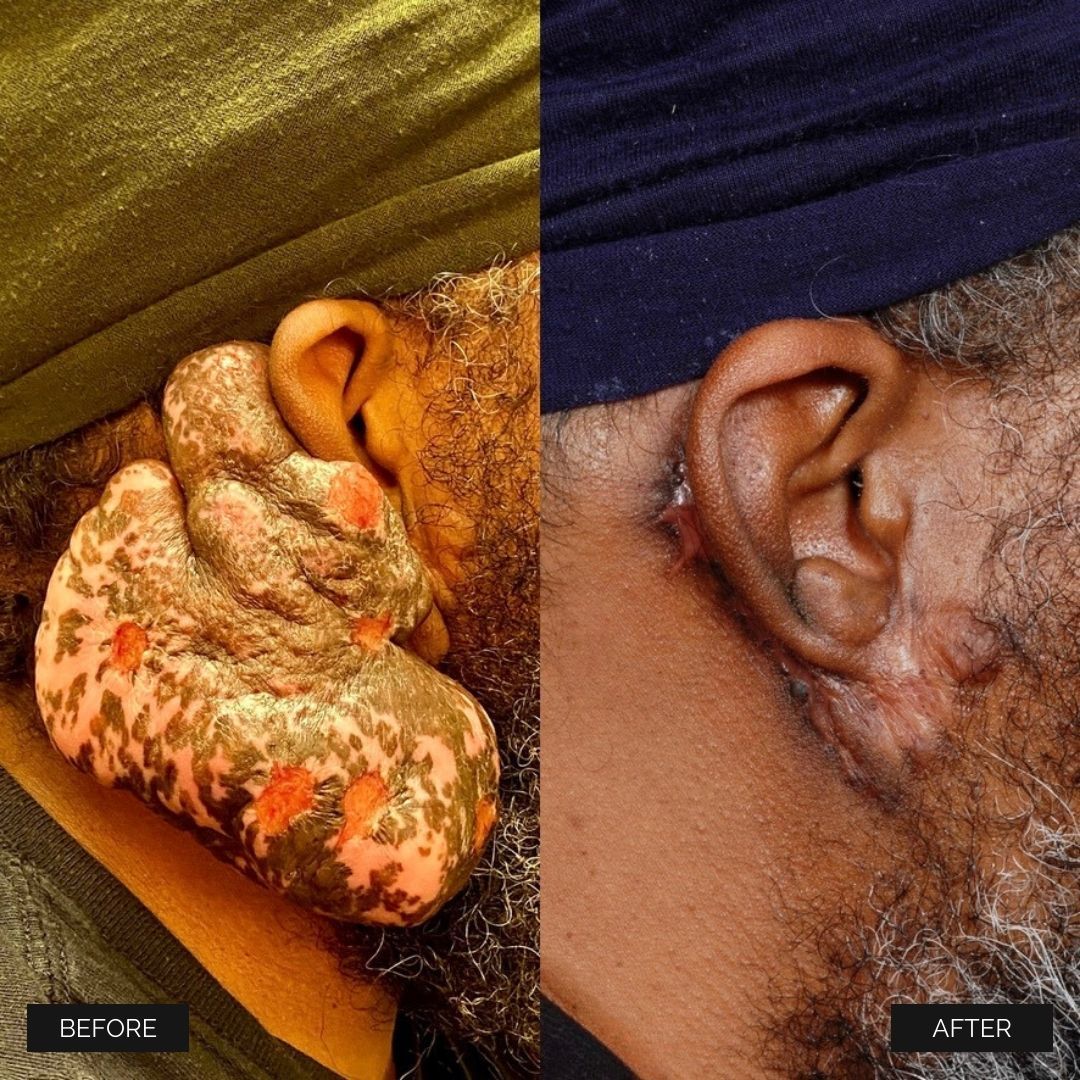 Reconstruction Before & After