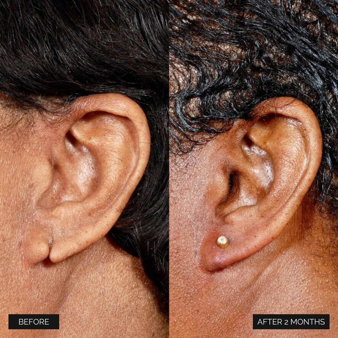 Reconstruction Before & After