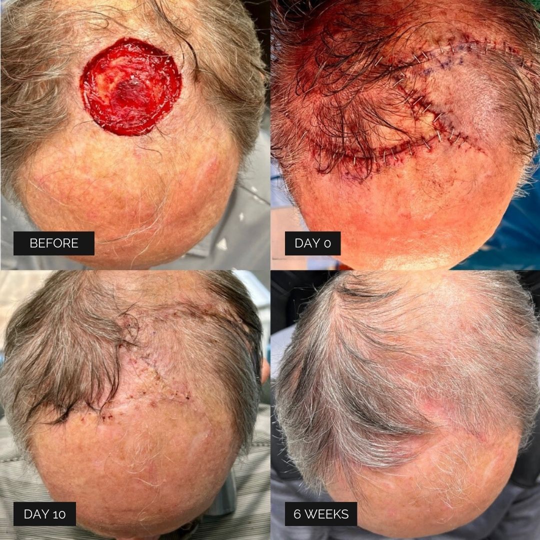 Reconstruction Before & After