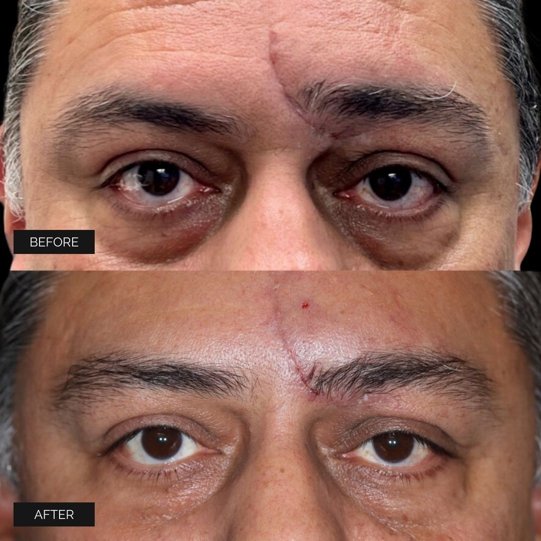 Reconstruction Before & After