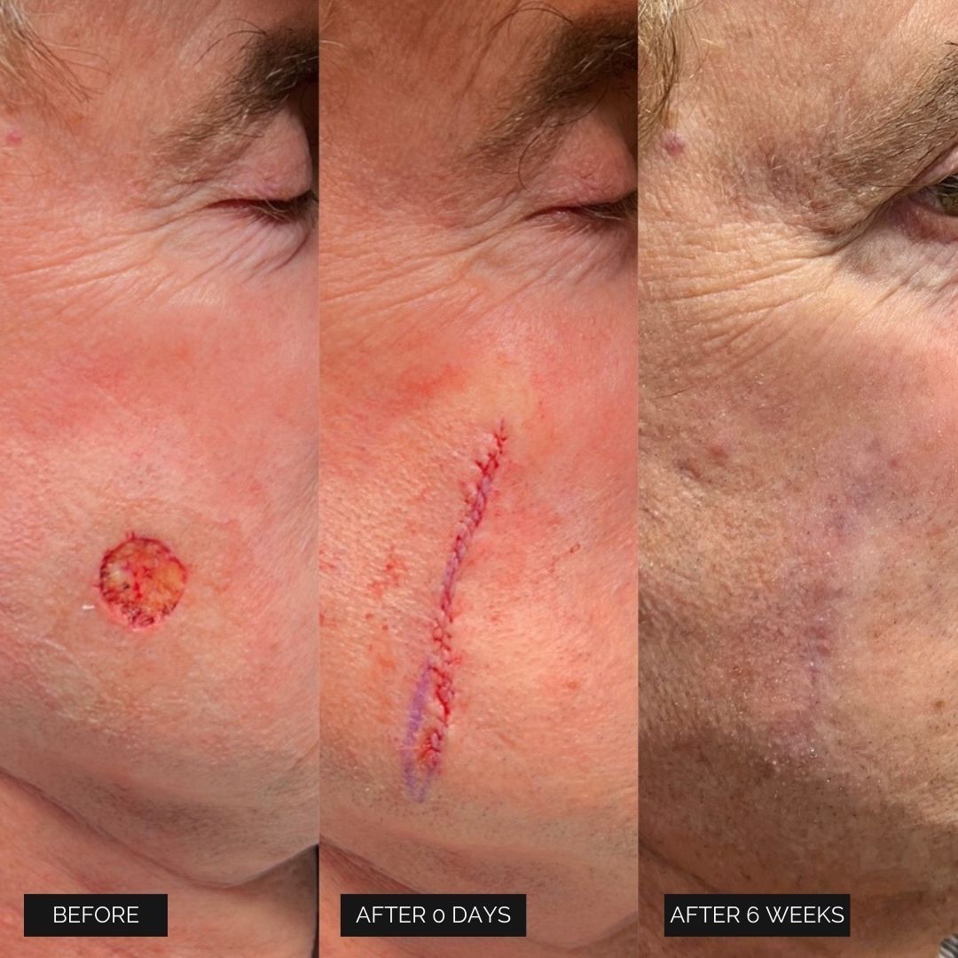 Reconstruction Before & After