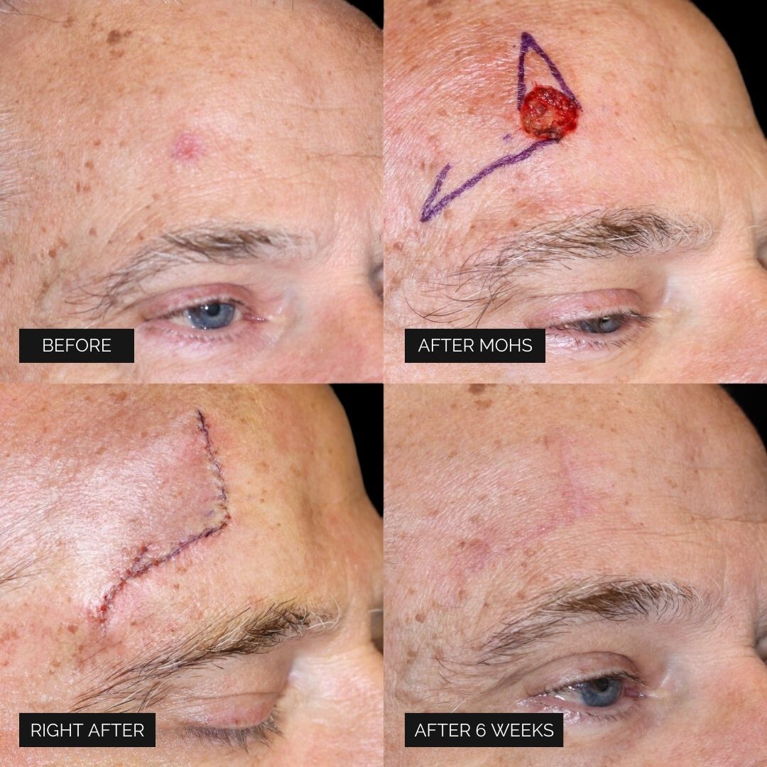 Reconstruction Before & After